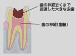 ドッグズベスト1