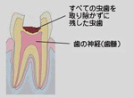 ドッグズベスト2