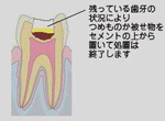 ドッグズベスト4