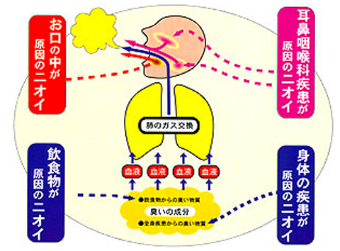 口臭ケア
