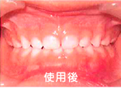 使用後