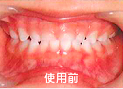 使用前